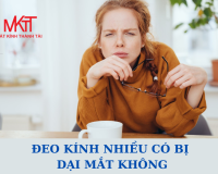 ĐEO KÍNH NHIỀU CÓ BỊ DẠI MẮT KHÔNG